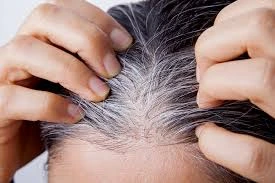 21.Health_Tips_-White_hair_problem