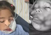 ಕ್ಯಾಂಡಿ ಬದಲು ಗನ್ಪೌಡರ್ ಅಗಿದ ಬಾಲಕಿಗೆ ಗಾಯ