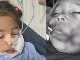 ಕ್ಯಾಂಡಿ ಬದಲು ಗನ್ಪೌಡರ್ ಅಗಿದ ಬಾಲಕಿಗೆ ಗಾಯ