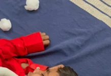 ಜಮಖಂಡಿಯಲ್ಲಿ ಬೀದಿ ನಾಯಿದಾಳಿ: 6 ವರ್ಷದ ಮಗುವಿಗೆ ಗಂಭೀರ ಗಾಯ