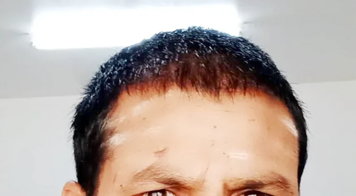 ವಿದ್ಯುತ್ ತಂತಿ ತಗುಲಿ ರೈತ ಸಾವು