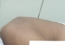 ಹಬೊಹಳ್ಳಿ : ಗೂಳಿ ಹಿರಿತ ಮೂವರಿಗೆ ಗಾಯ